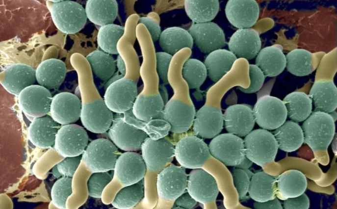 你知道吗？消毒和灭菌完全是不同的概念哦？